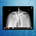 Rheumatoid Arthritis eLearning